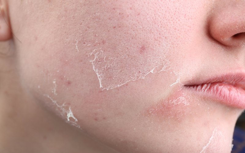 Sử dụng sản phẩm hỗ trợ và thuốc