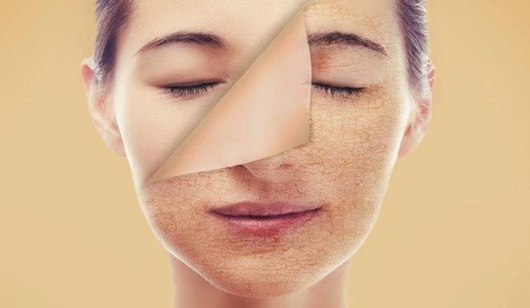 Da khô: Nhận biết, nguyên nhân và cách điều trị