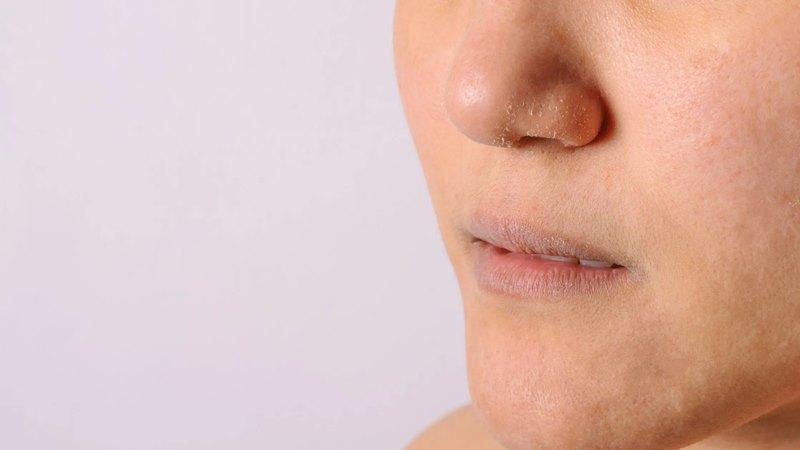 Da khô do thói quen sinh hoạt