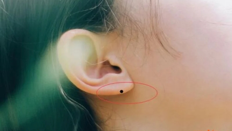 Nốt ruồi ở dái tai thường gắn liền với phúc khí