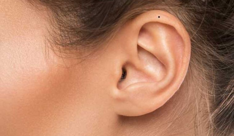 Nốt Ruồi Son Ở Đàn Ông