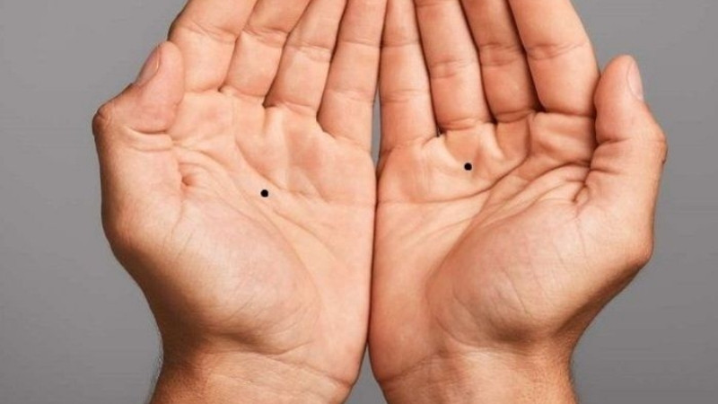 Nốt ruồi đen tiết lộ vận mệnh tiềm ẩn