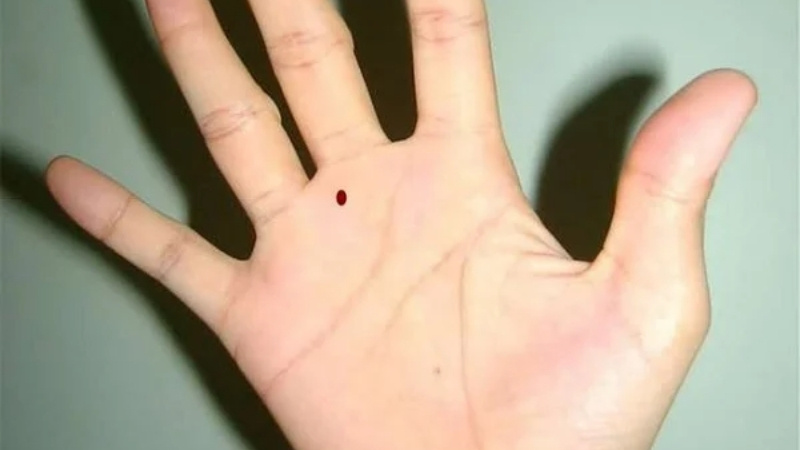 Nốt ruồi tay phải nữ tiết lộ vận mệnh riêng.