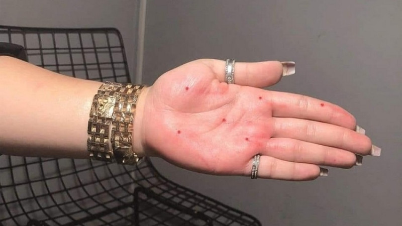 Khám phá 17 vị trí nốt ruồi mang vận mệnh