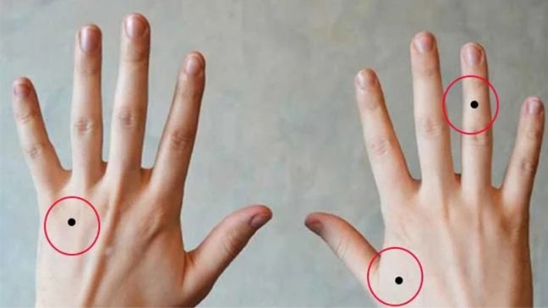 Ý nghĩa vị trí nốt ruồi trên tay