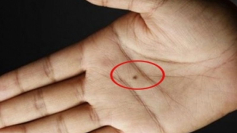 Nốt ruồi tay phải nam giới thể hiện sự thành đạt