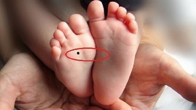 Nốt ruồi lòng bàn chân báo hiệu vận may và phú quý