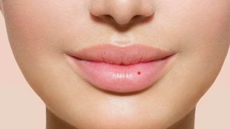 Nốt ruồi ở viền môi trên bên trái phụ nữ biểu thị duyên dáng, tài vận tốt
