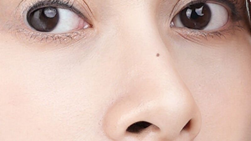 Nốt ruồi trên sống mũi thể hiện sự thông minh, nhạy bén