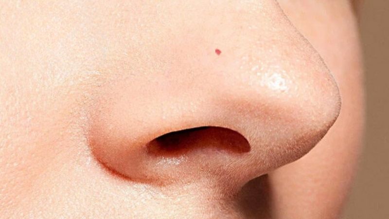 Nốt ruồi son ở mũi tượng trưng cho tài lộc và may mắn
