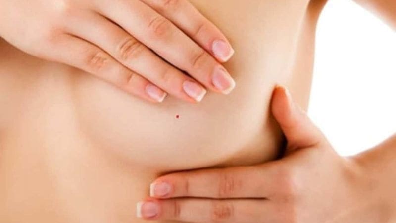 Nốt ruồi xung quanh bầu ngực tiết lộ vận mệnh và tính cách