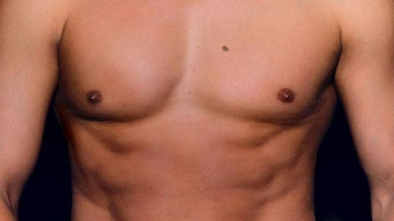 Nốt ruồi ở phần trên ngực bên phải mang nhiều ý nghĩa phong thủy