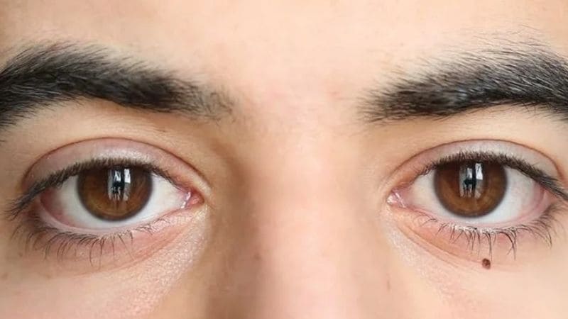 Những thắc mắc phổ biến được giải đáp chi tiết và rõ ràng Những thắc mắc phổ biến được giải đáp chi tiết và rõ ràng