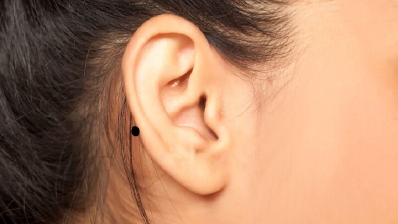 Nốt ruồi phú quý trên mặt phụ nữ ở vị trí tai là dấu hiệu phúc khí, giúp phụ nữ thông minh, nhân hậu và có cuộc sống sung túc