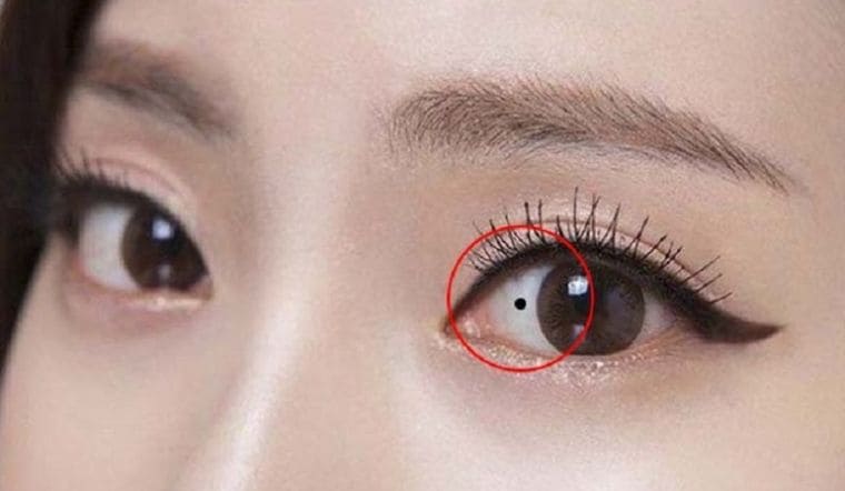 Nốt ruồi trong mắt là tốt hay xấu? Ý nghĩa nốt ruồi trong mắt