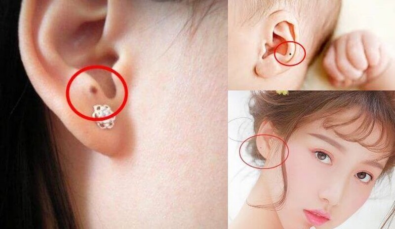 Nốt ruồi ở tai là biểu tượng của phúc lộc