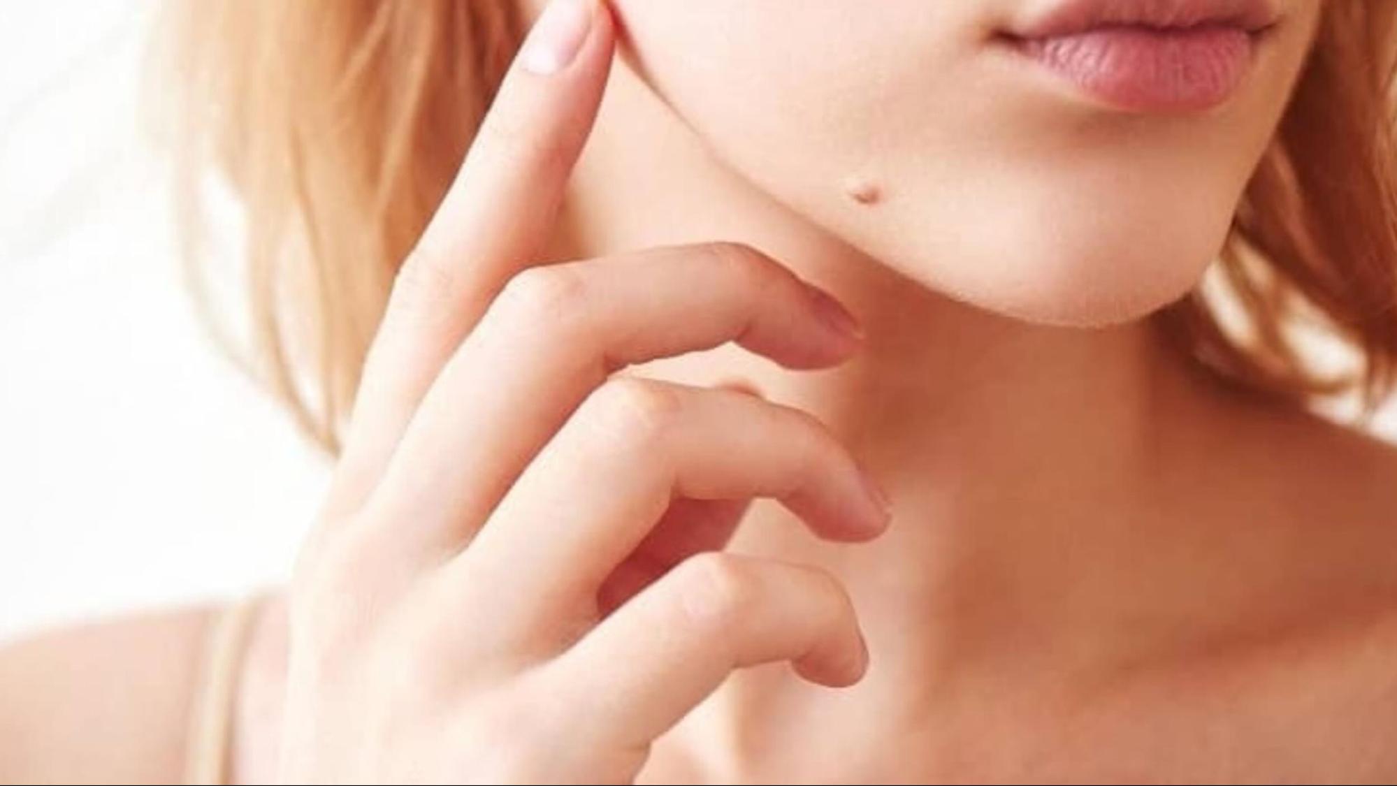 Nốt ruồi ở môi trên là một trong những vị trí nốt ruồi trên mặt không nên xóa