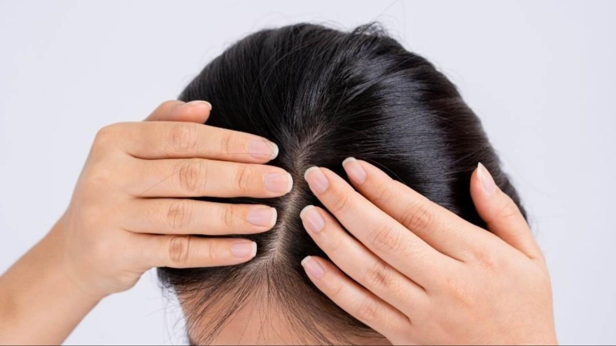 Nốt ruồi ở trung tâm đỉnh đầu được cho là biểu tượng của may mắn và phúc khí.