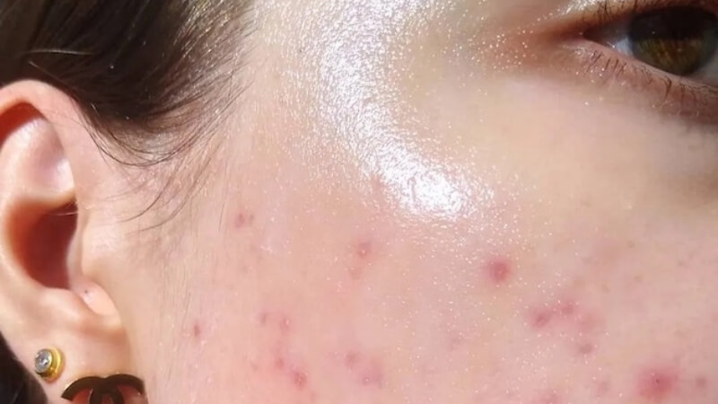 Cách lựa chọn sữa rửa mặt phù hợp theo độ tuổi và loại da