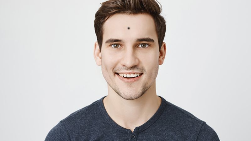 Nốt ruồi giữa trán ở nam giới