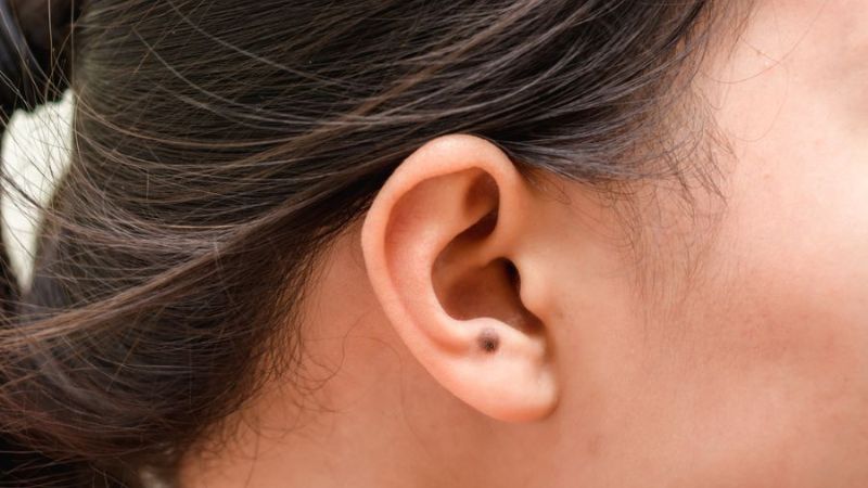 Người có nốt ruồi ở vành tai phải thường sống thọ, khỏe mạnh và gặp nhiều may mắn trong cuộc sống Người có nốt ruồi ở vành tai phải thường sống thọ, khỏe mạnh và gặp nhiều may mắn trong cuộc sống