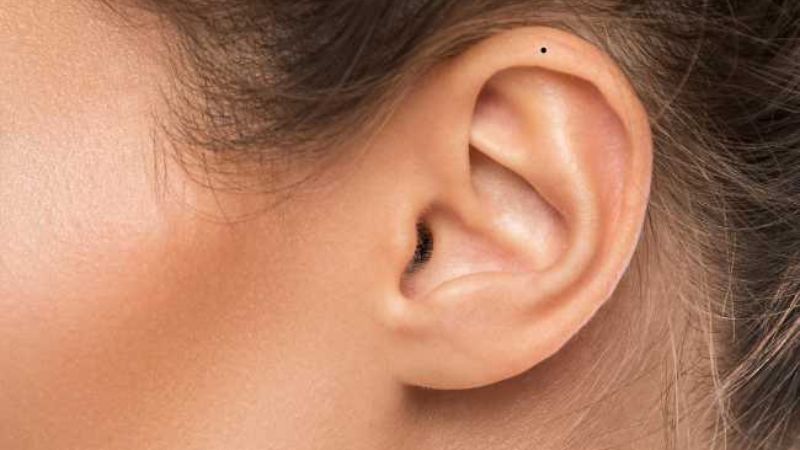 Người có nốt ruồi ở vành tai trái thường thông minh, sống tình cảm và được quý nhân giúp đỡ Người có nốt ruồi ở vành tai trái thường thông minh, sống tình cảm và được quý nhân giúp đỡ