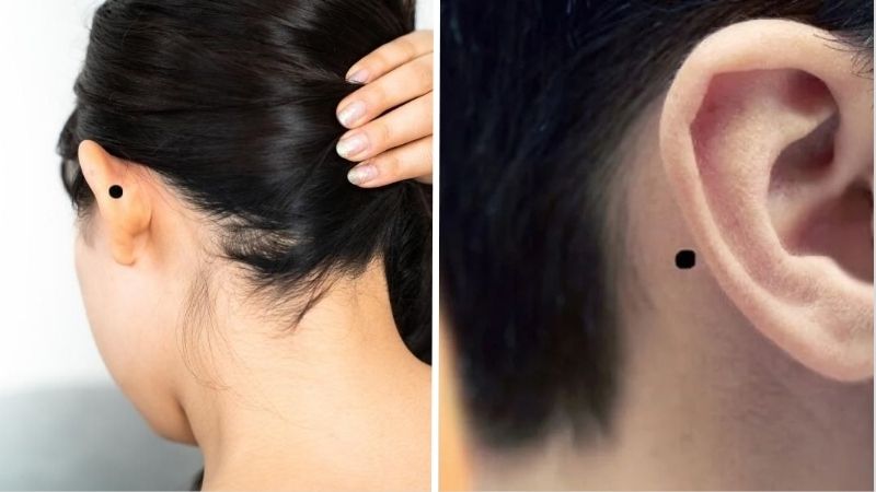 Nốt ruồi sau vành tai trái là điềm tốt, tượng trưng cho người có tài, sống đạo đức, hiếu thuận Nốt ruồi sau vành tai trái là điềm tốt, tượng trưng cho người có tài, sống đạo đức, hiếu thuận