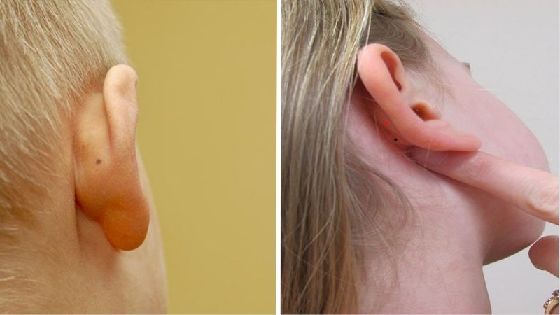 Nốt ruồi sau vành tai phải nam, nữ biểu hiện của sự thông minh, nhạy bén, có khả năng quan sát và xử lý tình huống tốt Nốt ruồi sau vành tai phải nam, nữ biểu hiện của sự thông minh, nhạy bén, có khả năng quan sát và xử lý tình huống tốt