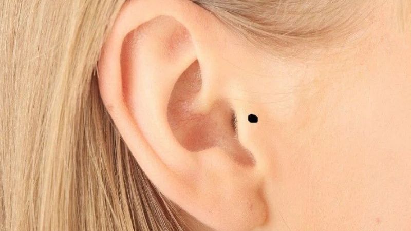 Người có nốt ruồi sau tai thường hiền lành, hiếu thảo và có hậu vận tốt nhờ được gia đình nâng đỡ Người có nốt ruồi sau tai thường hiền lành, hiếu thảo và có hậu vận tốt nhờ được gia đình nâng đỡ