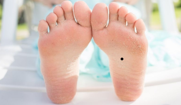 Giải mã toàn tập về nốt ruồi ở lòng bàn chân: Tướng số phú quý và những lưu ý