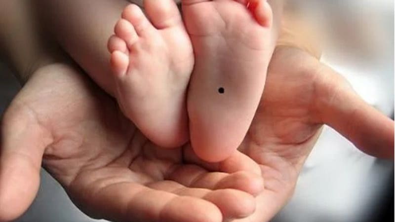 Chăm sóc đúng cách giúp ngăn kích ứng và phát hiện sớm dấu hiệu bất thường