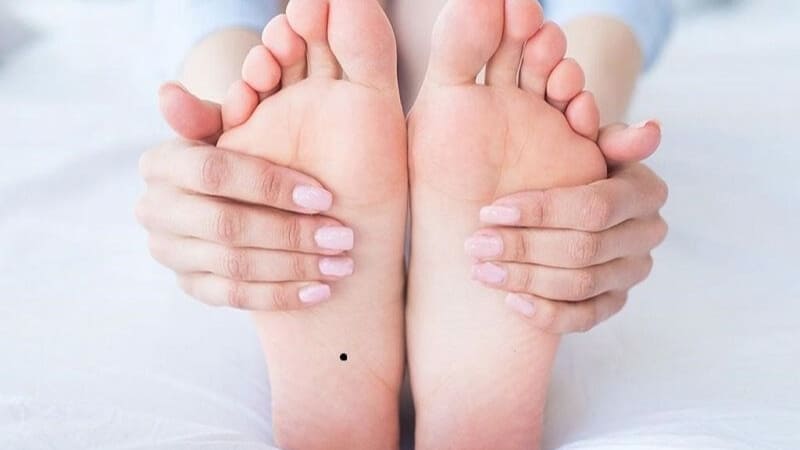 Nốt ruồi ở lòng bàn chân có thể tiềm ẩn rủi ro sức khỏe