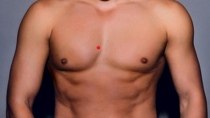 Nốt ruồi bất thường về màu sắc, hình dạng, gây đau có thể là dấu hiệu cảnh báo bệnh lý Nốt ruồi bất thường về màu sắc, hình dạng, gây đau có thể là dấu hiệu cảnh báo bệnh lý