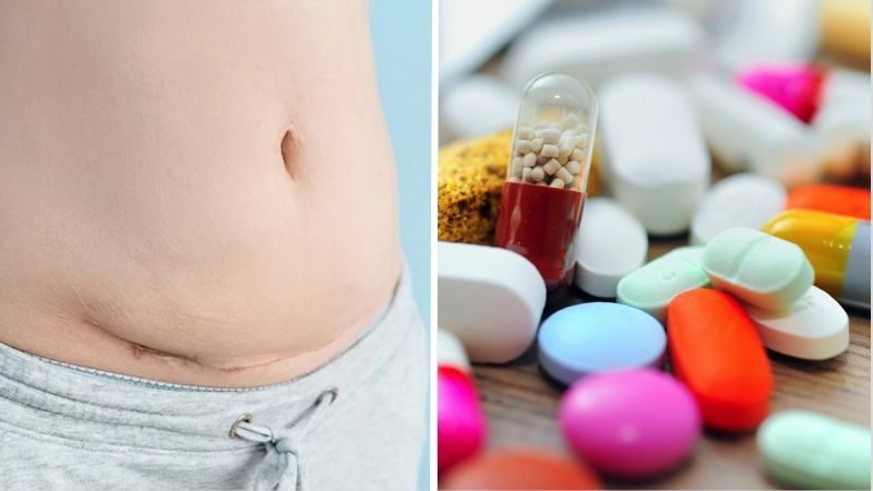 Người mới phẫu thuật bụng và sử dụng thuốc kháng sinh thì không nên uống Ensure