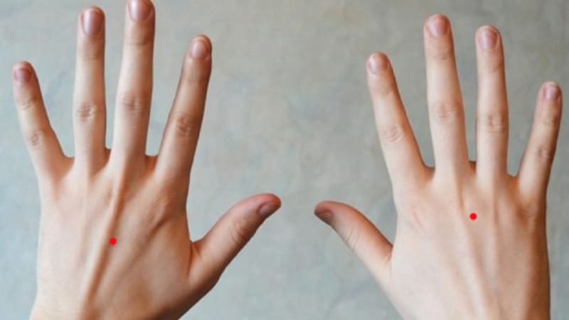 Xóa nốt ruồi nên cân nhắc kỹ cả về y khoa lẫn thẩm mỹ