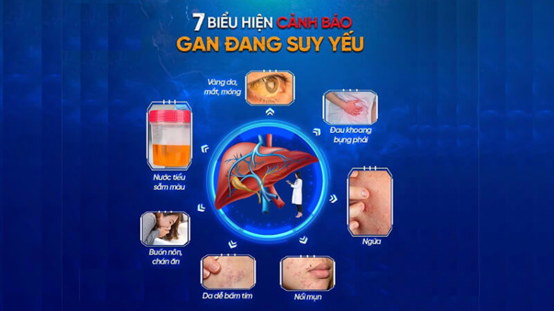 Dấu hiệu của bệnh gan