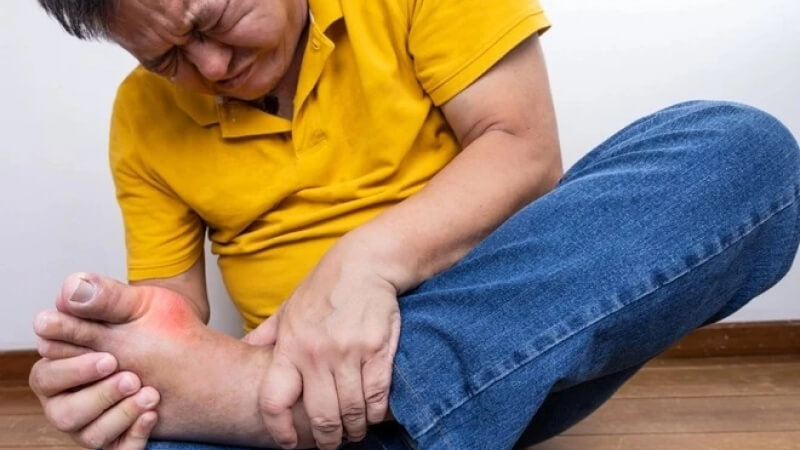 Người bị gout cấp tính