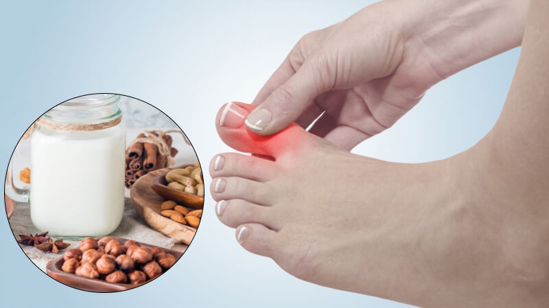 Sữa nào tốt cho người bị bệnh gout