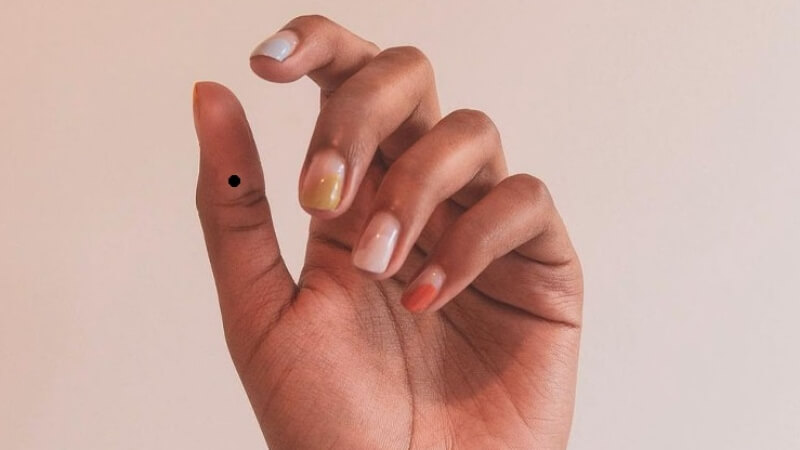 Nốt ruồi ở ngón tay cái tượng trưng cho cha mẹ, phúc đức