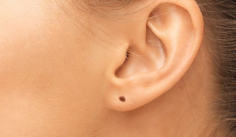 Nốt ruồi ở dái tai: Hé lộ vận mệnh Phú Quý, Trường Thọ hay Gian Truân?
