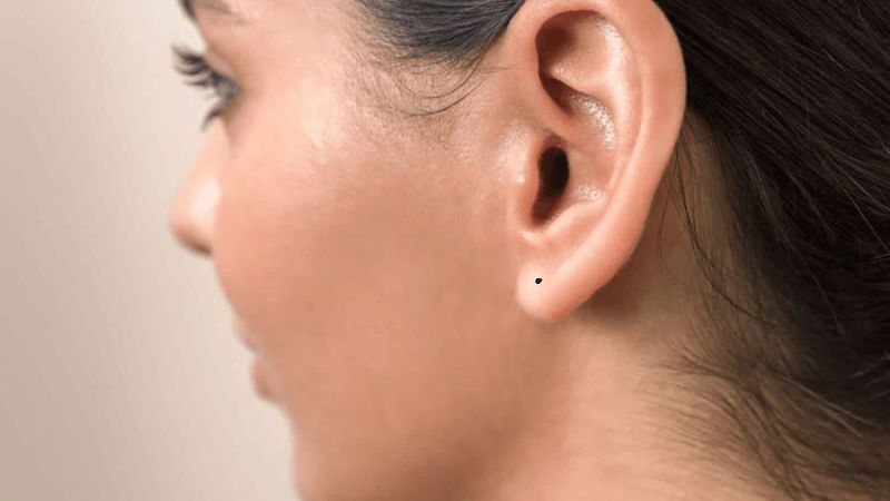 Nốt ruồi ở dái tai là dấu hiệu của phúc khí, tài lộc và may mắn