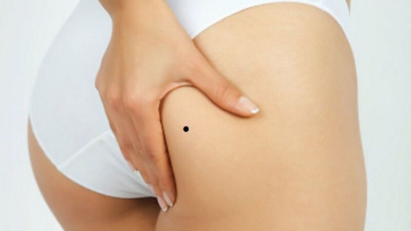 Phụ nữ có nốt ruồi ở mông phải thường gặp may mắn, sống quyết đoán