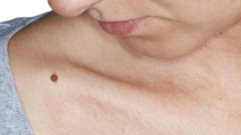 Nốt ruồi son ở xương quai xanh tượng trưng cho vận may bền vững và tình duyên thuận lợi
