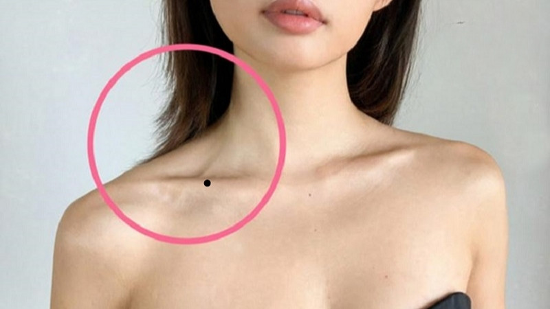 Tẩy nốt ruồi ở vị trí phú quý có thể bị xem là làm mất đi vận may theo quan niệm tướng số