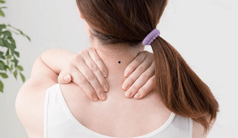 Ý nghĩa nốt ruồi sau gáy nữ: Giải mã vận mệnh, tình duyên và sự nghiệp