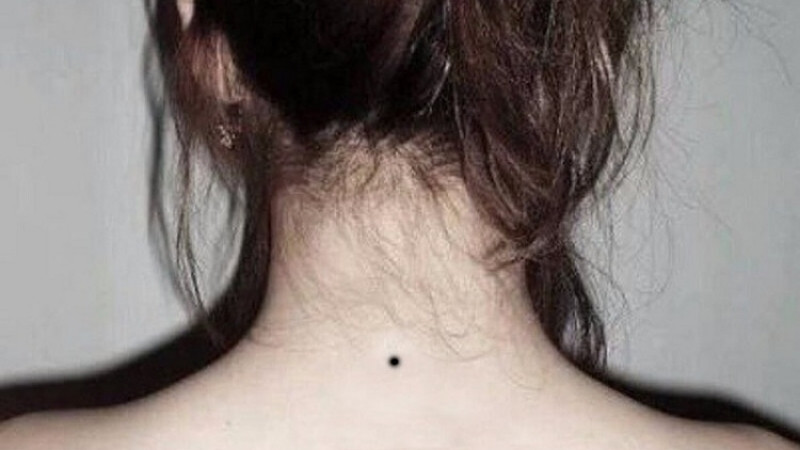 Nốt ruồi giữa gáy là vị trí “kỵ”, có thể gây bất lợi