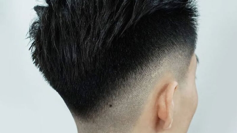 Nốt ruồi ẩn trong tóc, khó thấy