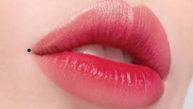 Nốt ruồi ở mép/khóe môi trên