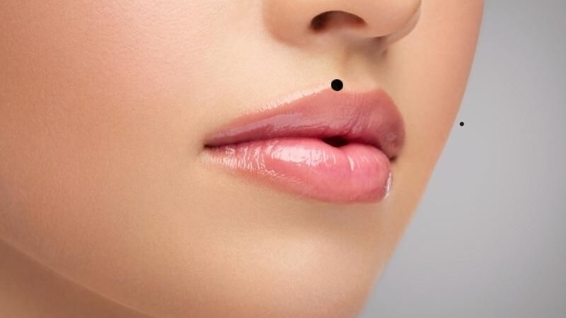 Nốt ruồi ở môi trên bên trái (Nam/Nữ)