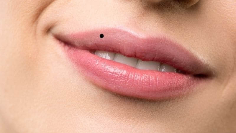 Các câu hỏi liên quan về nốt ruồi ở môi trên